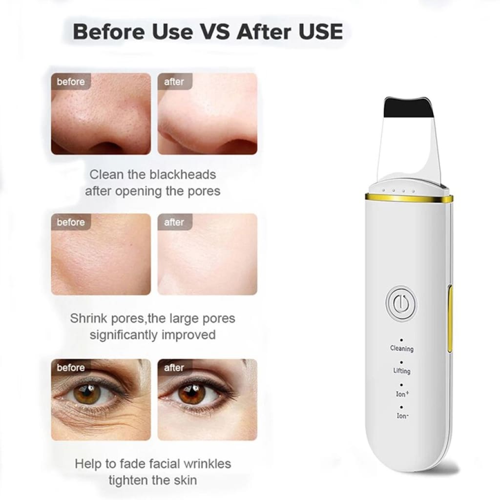 Ultrasonic Skin Scrubber Electric Vibration Deep Face Cleaning Peeling - Skincare Tools &amp; Device